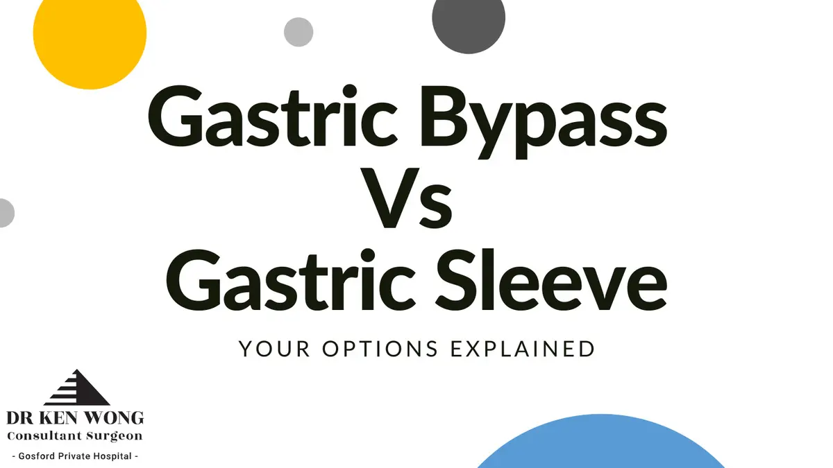 Gastric Bypass vs Gastric Sleeve Gastric Bypass vs Gastric Sleeve