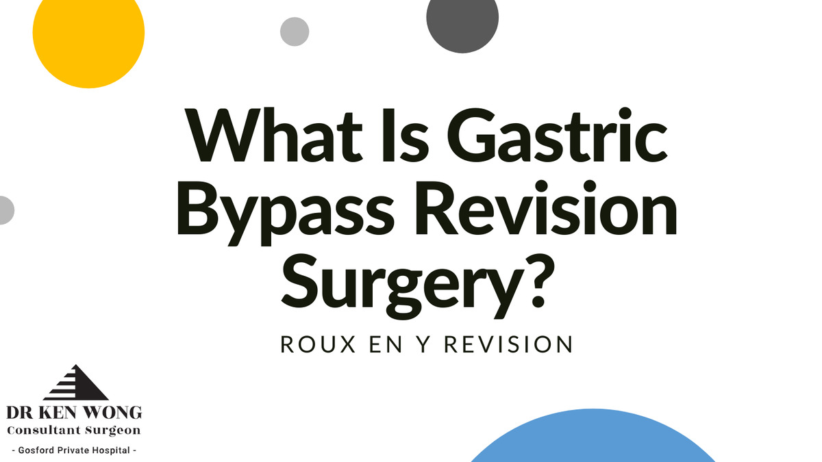 What Is Gastric Bypass Revision Surgery? What Is Gastric Bypass Revision Surgery?